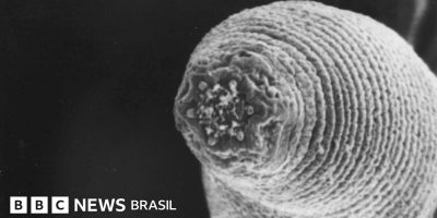 Legenda da foto, Esta imagem microscópica mostra a ponta afilada de um verme-do-diabo